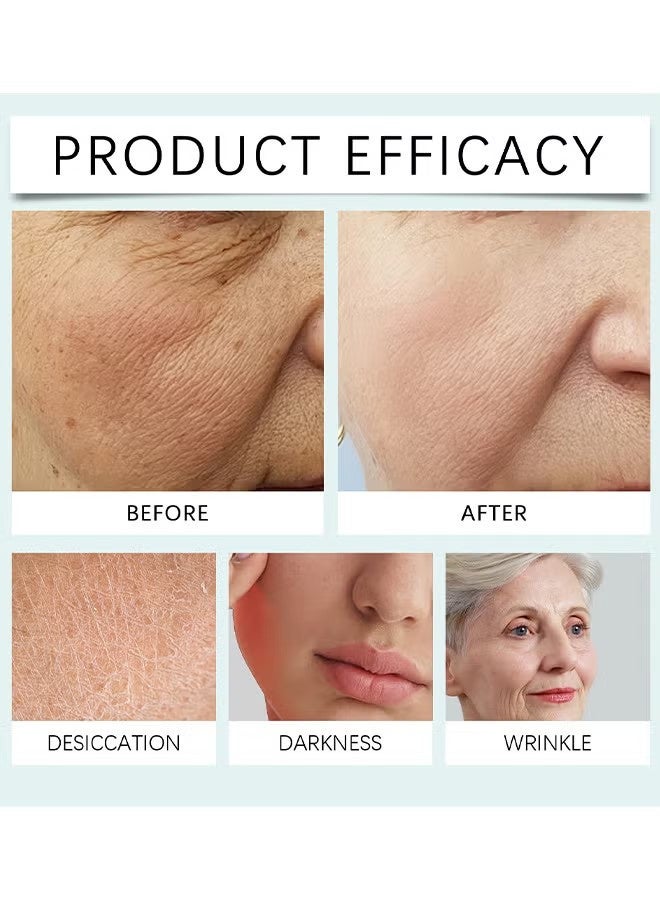 هويجي كريم الوجه 14-Day Skin Beauty Regimen Melasma, البقع العمرية البقع, التجاعيد أكثر سلاسة, كريم البقع الداكنة, لعلاج البقع والبقع لجميع أنواع الجلد, كريم الوجه المضادة للتجاعيد - Image 3